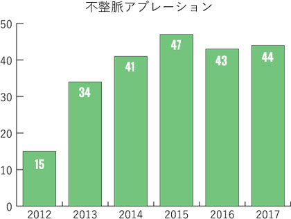 不整脈アブレーション