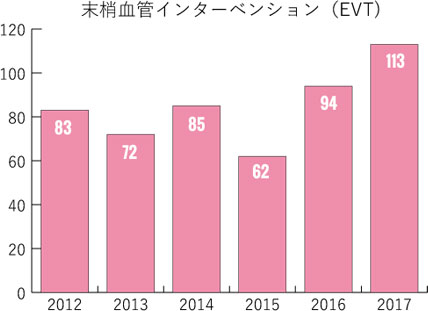 末梢血管インターベンション（EVT）